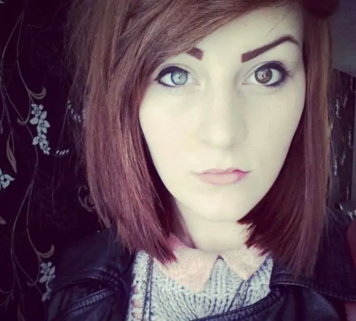 16 impactantes fotografías sobre mutación ocular