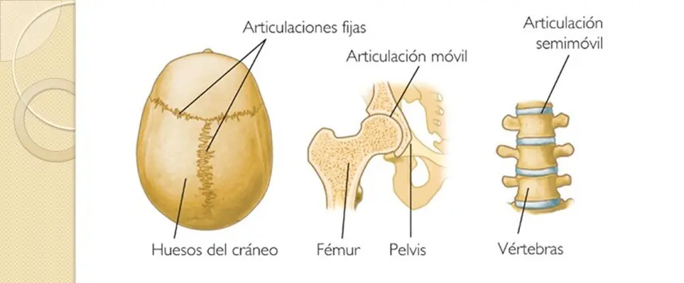 sistema