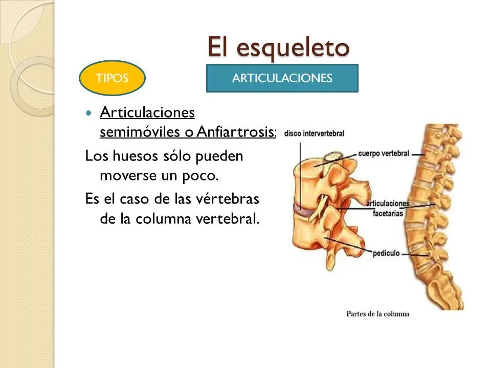 imagenes