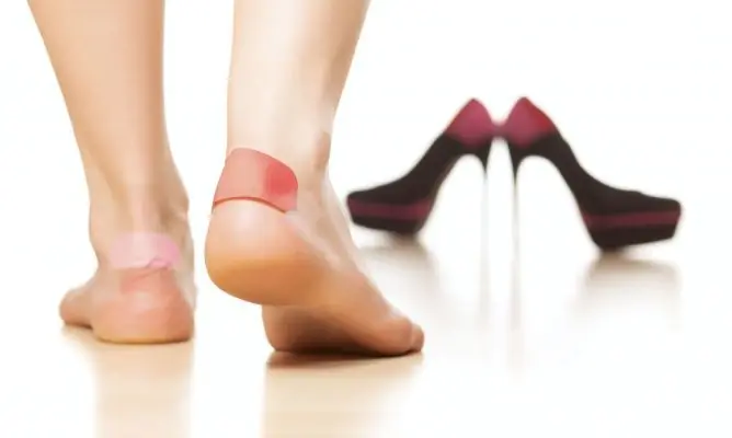 7 tips infalibles para evitar las rozaduras en los pies