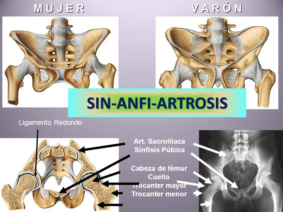 imagenes