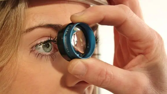 glaucoma