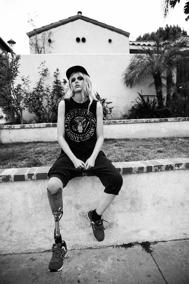 Lauren Wasser, modelo que sufrió una amputación