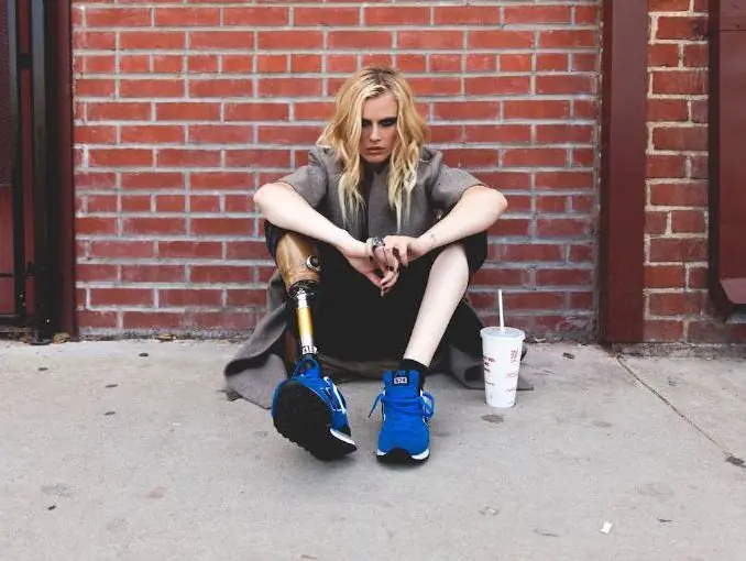 Lauren Wasser, modelo que sufrió una amputación