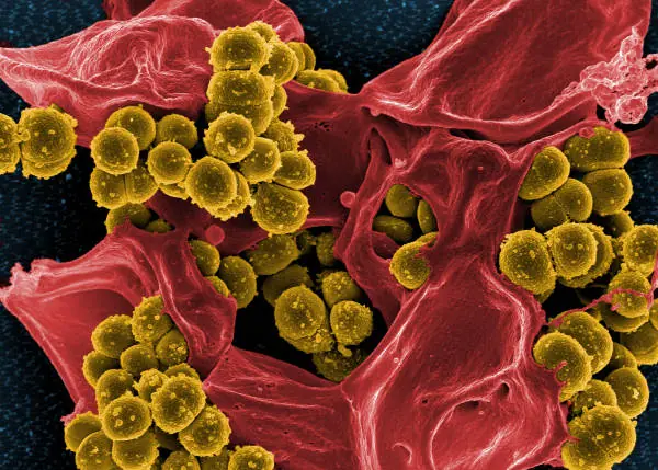 ¡Nos mienten! Bacterias extraterrestes, peligro espacial