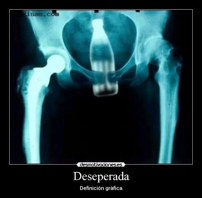 fotografias