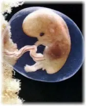 misoprostol (droga abortiva)