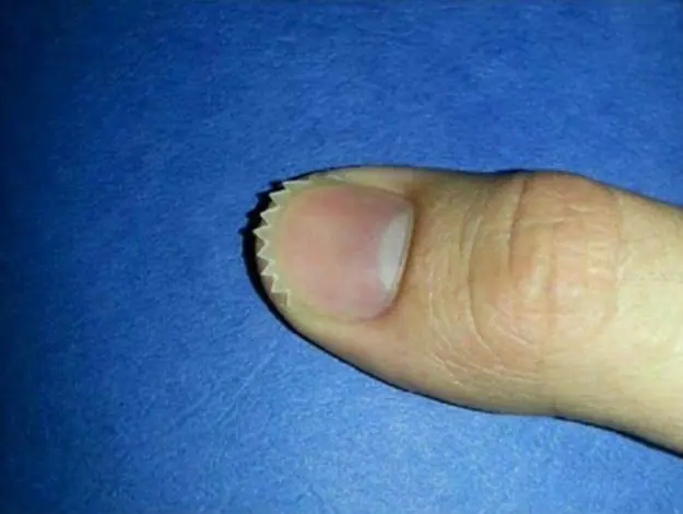 wtf