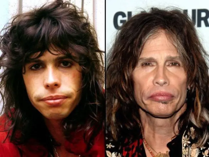 Estrellas del rock que envejecieron de la peor manera…