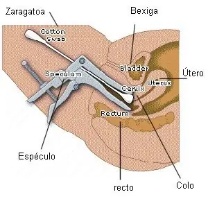 odiado