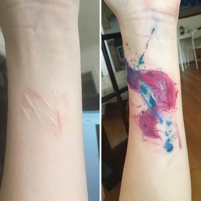 20 tatuajes que tapan cicatrices y cuentan una historia