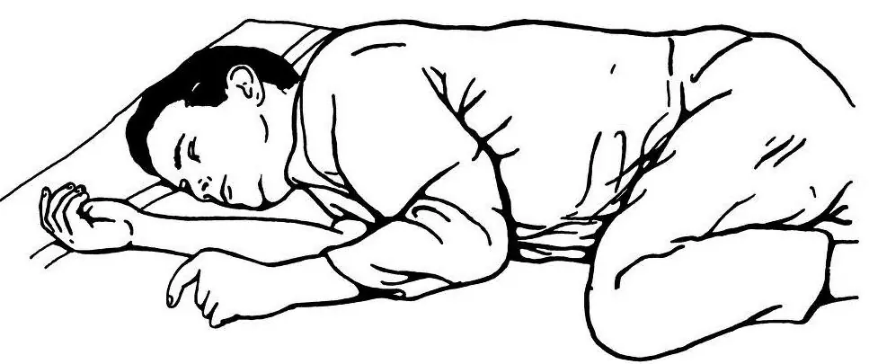 coma