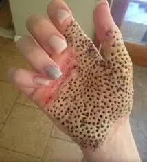 asco