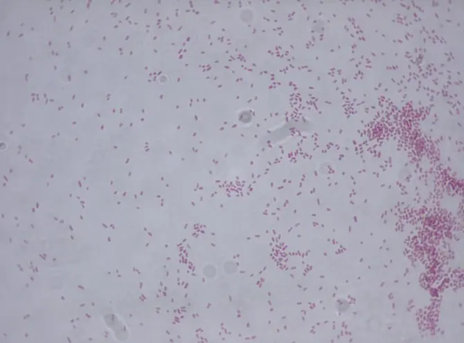 organizacion mundial de la salud