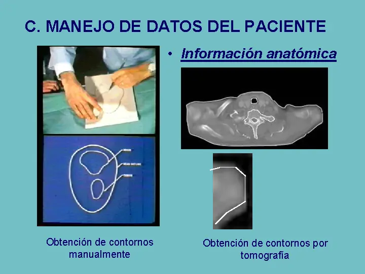Radioterapia sist de planificación y algoritmos de cálculos