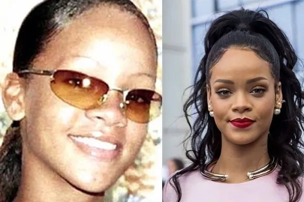 antes y despues
