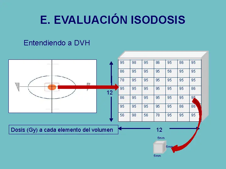 radioterapia
