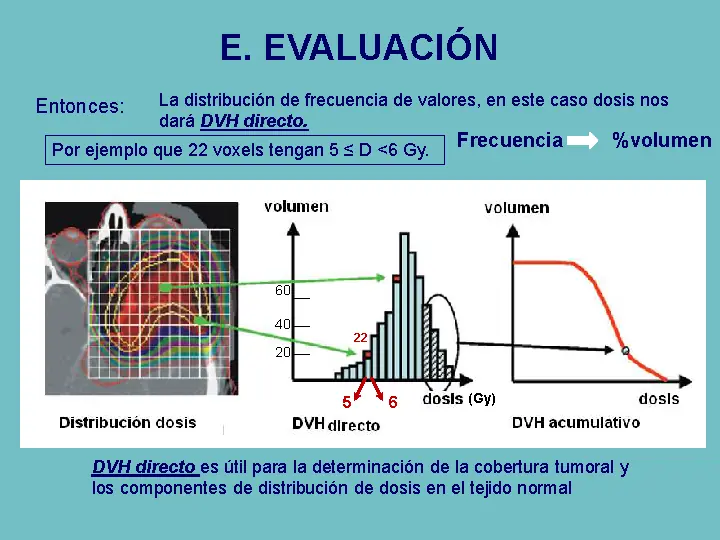 Radioterapia sist de planificación y algoritmos de cálculos