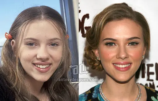 antes y despues