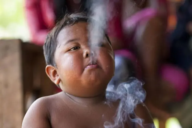 Asi esta hoy el niño que fumaba 40 cigarrillos diarios