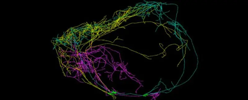 Hallan una neurona gigante cubriendo todo el cerebro