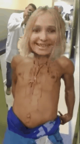 Tan drogado que ni un tiro en el rostro lo para...