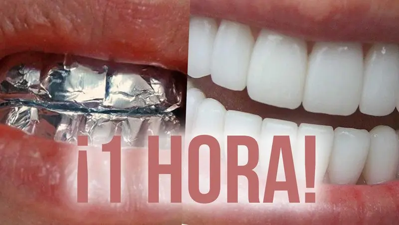Solución natural para tu dentadura
