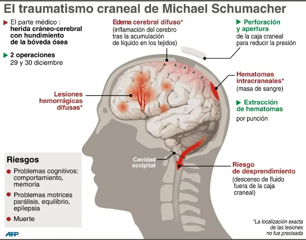 ¿Cómo es la vida después de despertar de un coma?