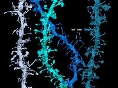 Imágenes de lo que les pasa a las neuronas al Dormir: adelga