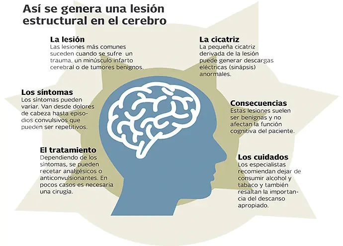 Rehabilitacion despues del coma