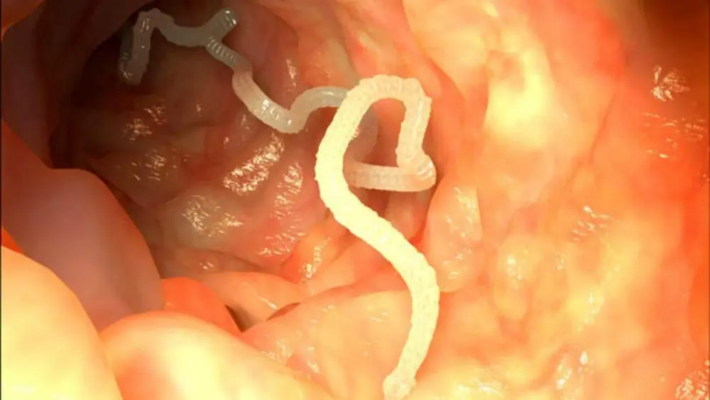 Tenia