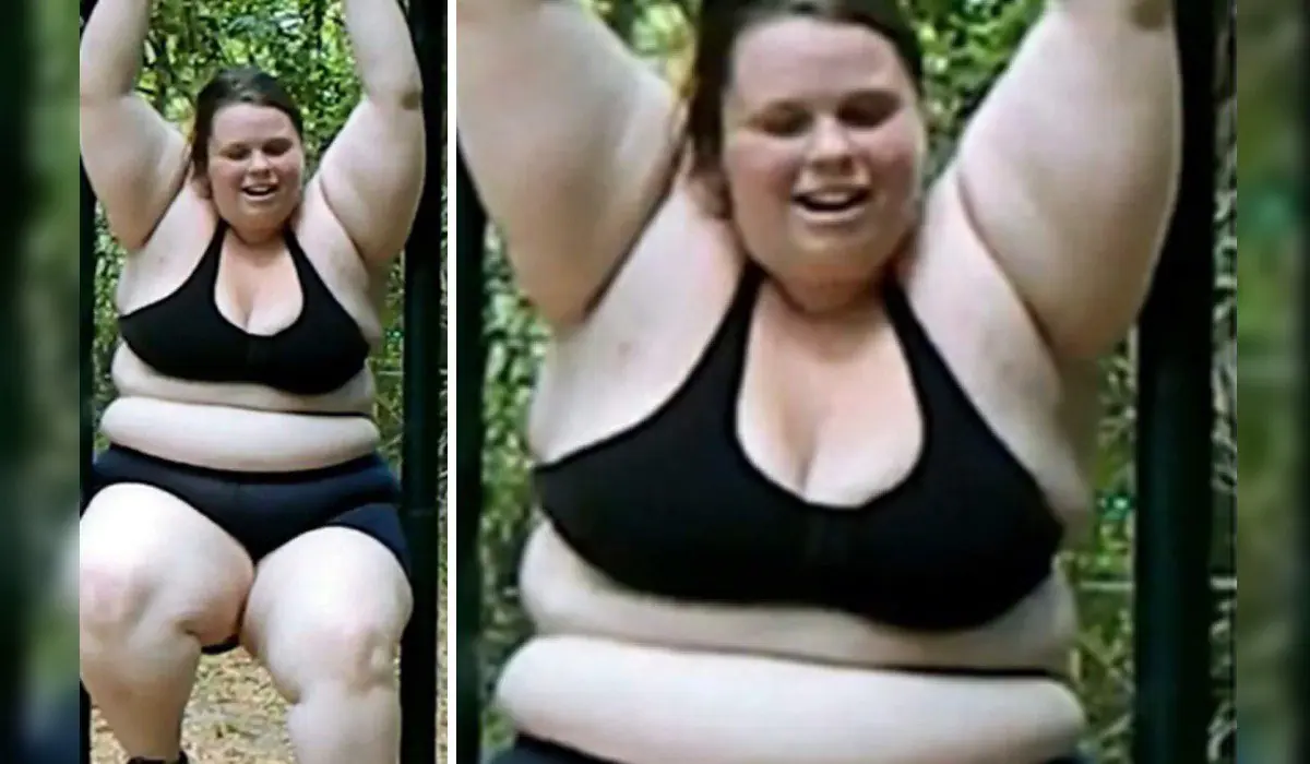 Perdió 88 kilos y quiso mostrar la parte fea de bajar de pes