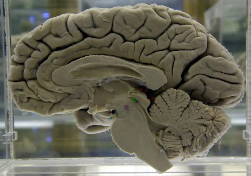 actividad cerebral actividad cerebral