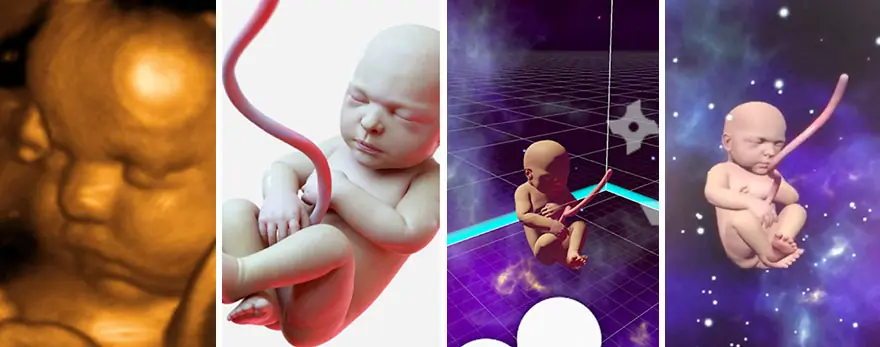 Padres ven por realidad virtual a su hija antes de nacer
