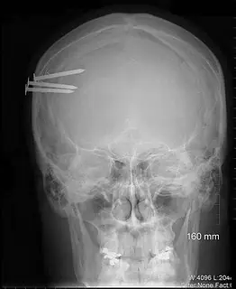 radiografias