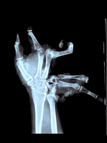 radiografias