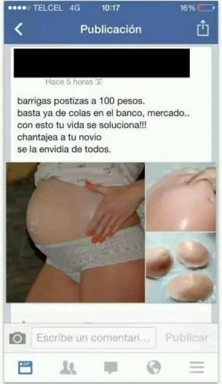 Estupidez