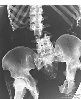 17 Radiografías Inusuales.