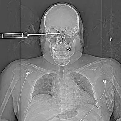 radiografias