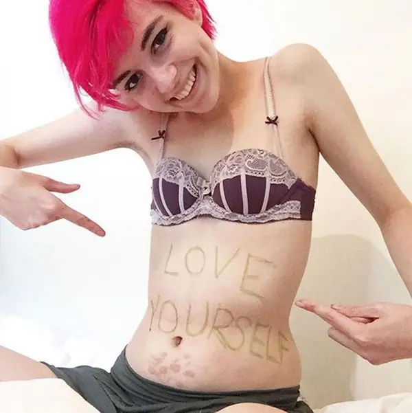 Sufrió de anorexia y documenta su asombrosa recuperación