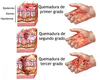 lesiones