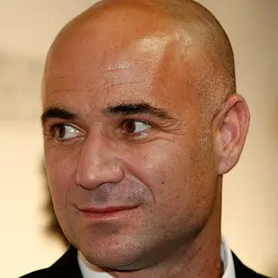 Quedarse pelado es en realidad genial