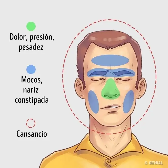 5 tipos