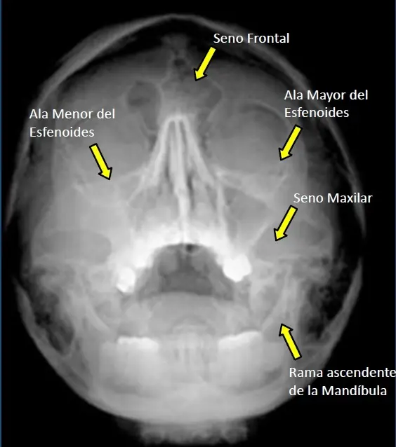 radiologia