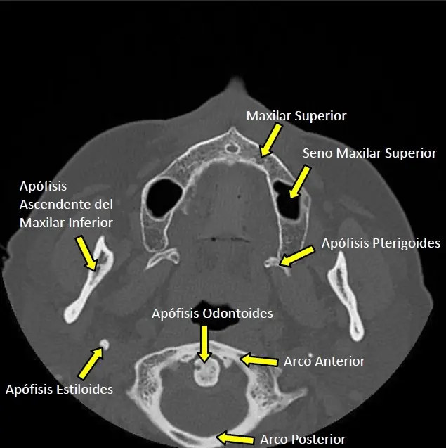 radiologia