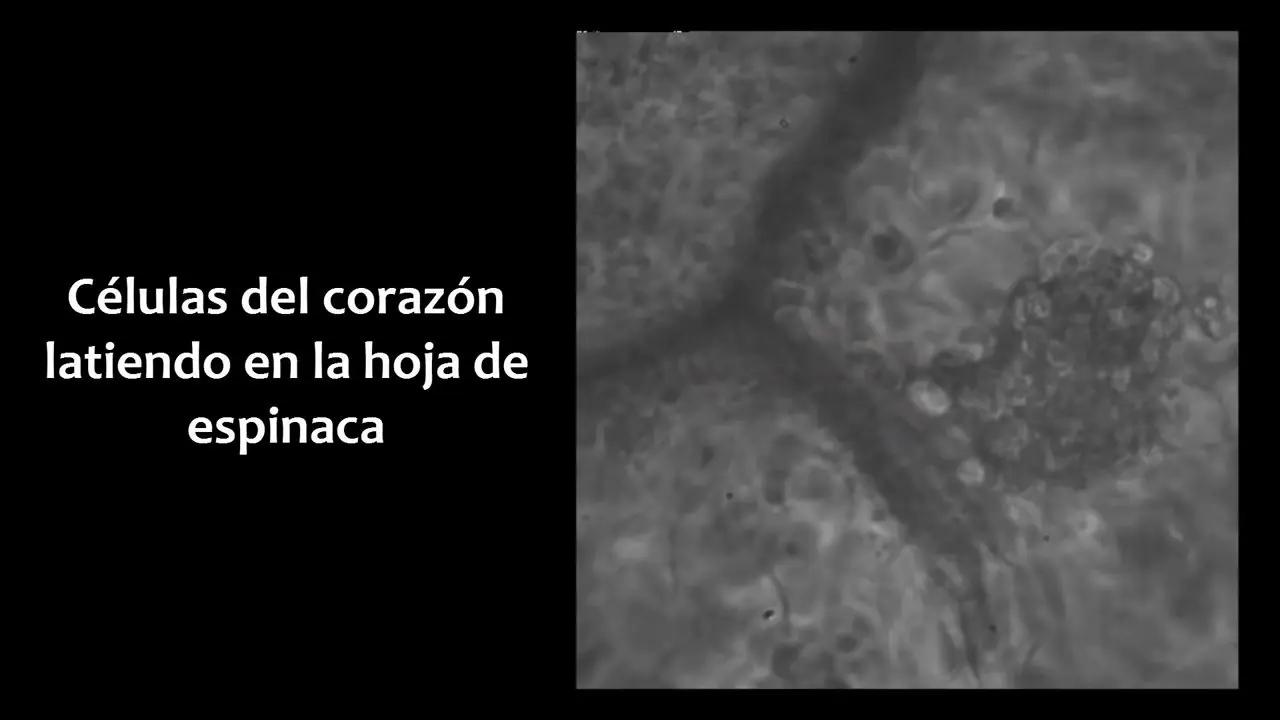 Sistema vascular