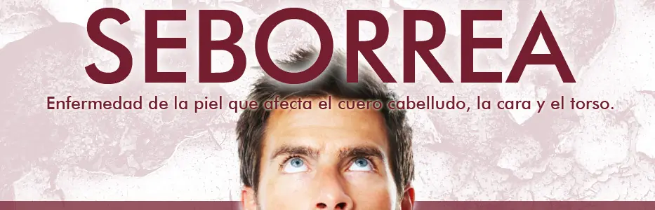 Tenes seborrea? pasate!! (experiencia personal)