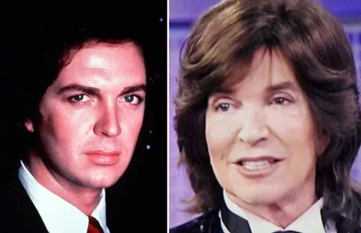 8 famosos que se pasaron con botox y cirugía estética