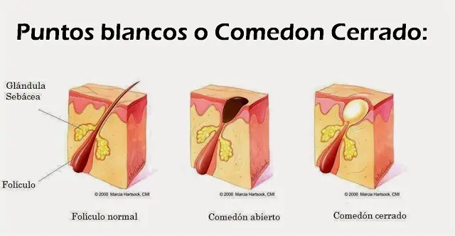 grados