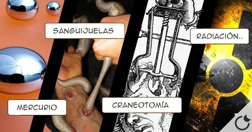 Procedimientos médicos que se creían curativos en el pasado.